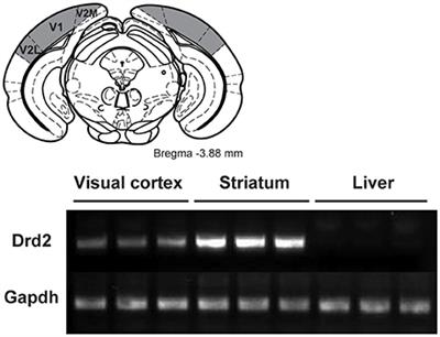 Spatial Frequency Selectivity Is Impaired in Dopamine D2 Receptor Knockout Mice